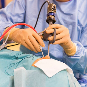 Эндоскопическая хирургия одонтогенных патологий гайморовой пазухи